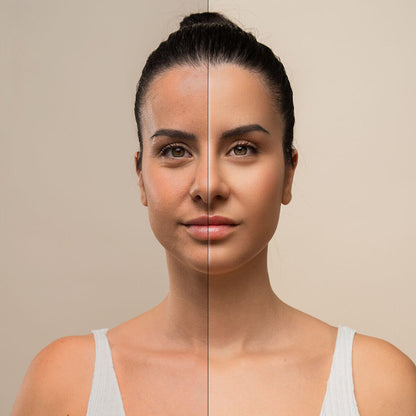 Masajeador Facial Zensoria™ GlowLift – Tonifica, Ilumina y Rejuvenece + Regalo Sérum CBD