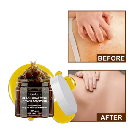 🌹Zensoria™ OCEAURA Jabón Negro con Argán y Rosa