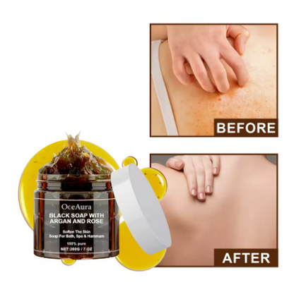 🌹Zensoria™ OCEAURA Jabón Negro con Argán y Rosa